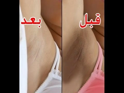 طرق تفتيح المناطق السمراء فى جسمك بكل سهولة :) | 102548