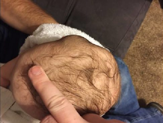 This Mother Was Horrified When She Saw Her Son s Head After A Day At Daycare | 106372