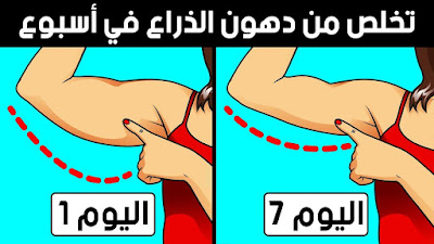 كيف تتخلص من دهون الذراع في 7 أيام – قل وداعًا للذراعين المترهلة! | 111405