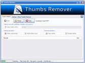 Xtreme-LAb&reg;: Thumbs Remover | 20143