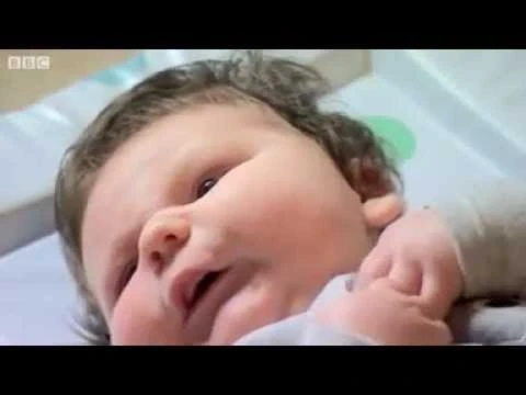 عشرون طبيباً لولادة أضخم طفل في العالم | 27261