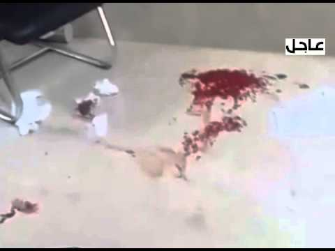 طالبة تطعن زميلتها بمجمع كليات سكاكا | youtube.com | 65151