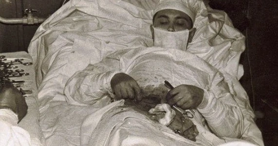 easy mese: Photos | Doctor being the excess process for himself without the help of a | 71955