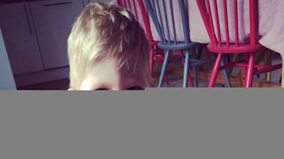 Miracle toddler wins modelling contract | 76770